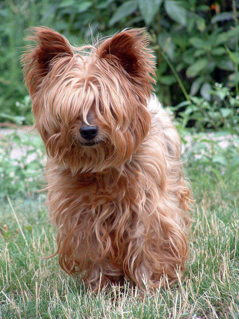 Syndrome du jumeau fantôme